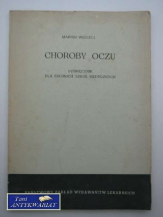 CHOROBY OCZU