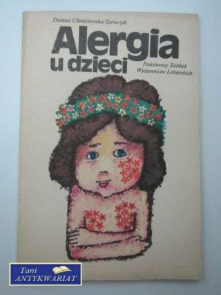 ALERGIA U DZIECI