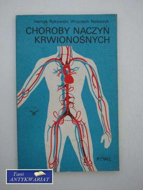 CHOROBY NACZYŃ KRWIONOŚNYCH CHOROBY NACZYŃ KRWIONOŚNYCH