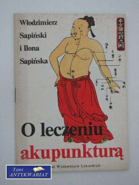 O LECZENIU AKUPUNKTURĄ