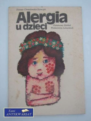 ALERGIA U DZIECI
