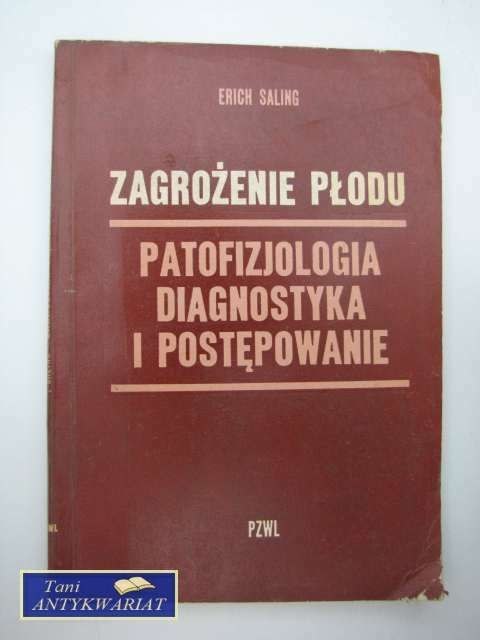ZAGROŻENIE PŁODU
