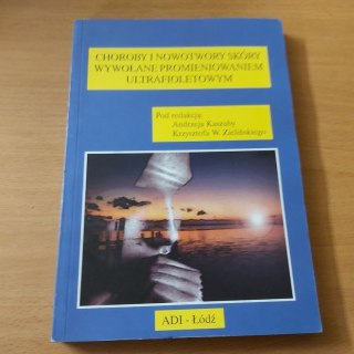 Choroby i nowotwory skóry wywołane promieniowaniem ultrafioletowym
